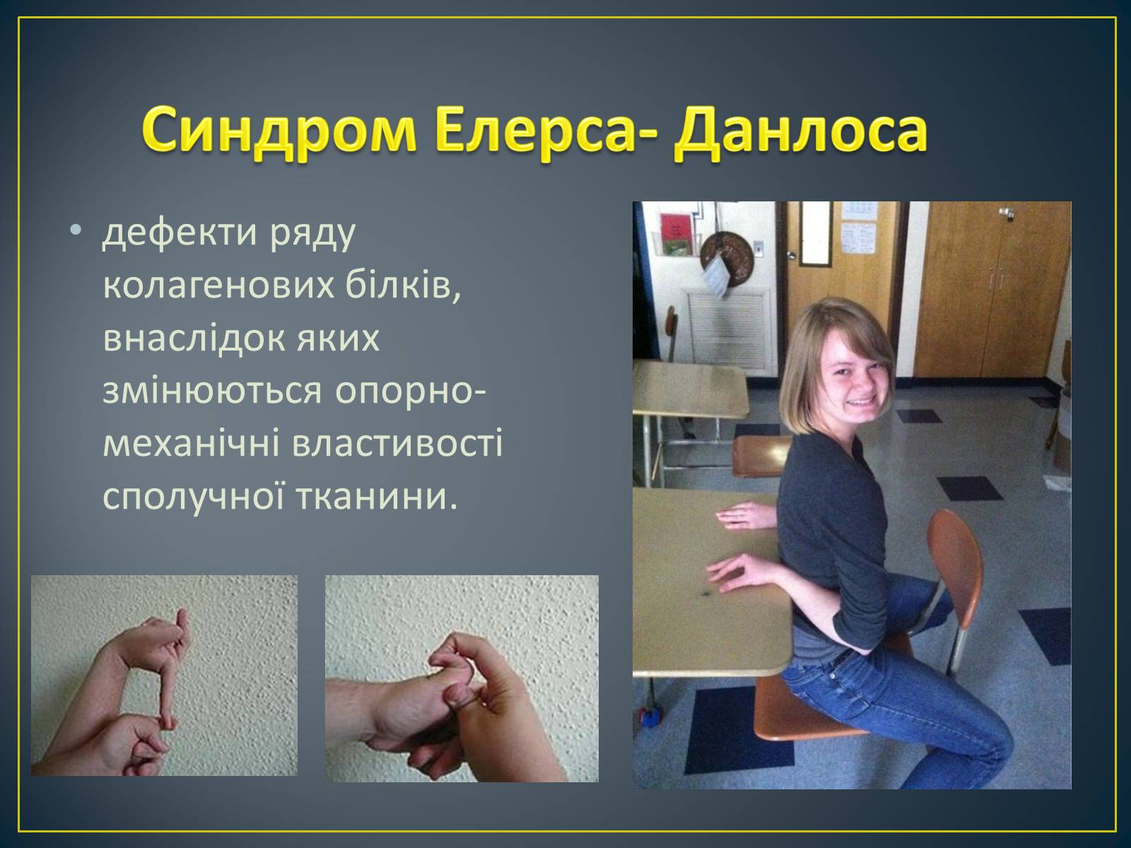 Презентація на тему «Типи генетичних хвороб людини» (варіант 2) - Слайд #9 Презентація на тему «Типи генетичних хвороб людини» (варіант 2) - Слайд #9