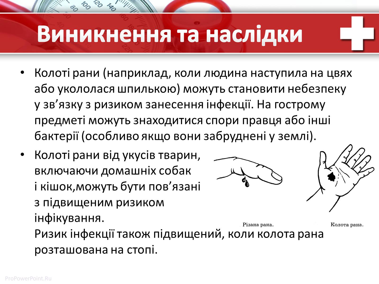 Презентація на тему «Колоті рани: перша допомога» - Слайд #2 Презентація на тему «Колоті рани: перша допомога» - Слайд #2
