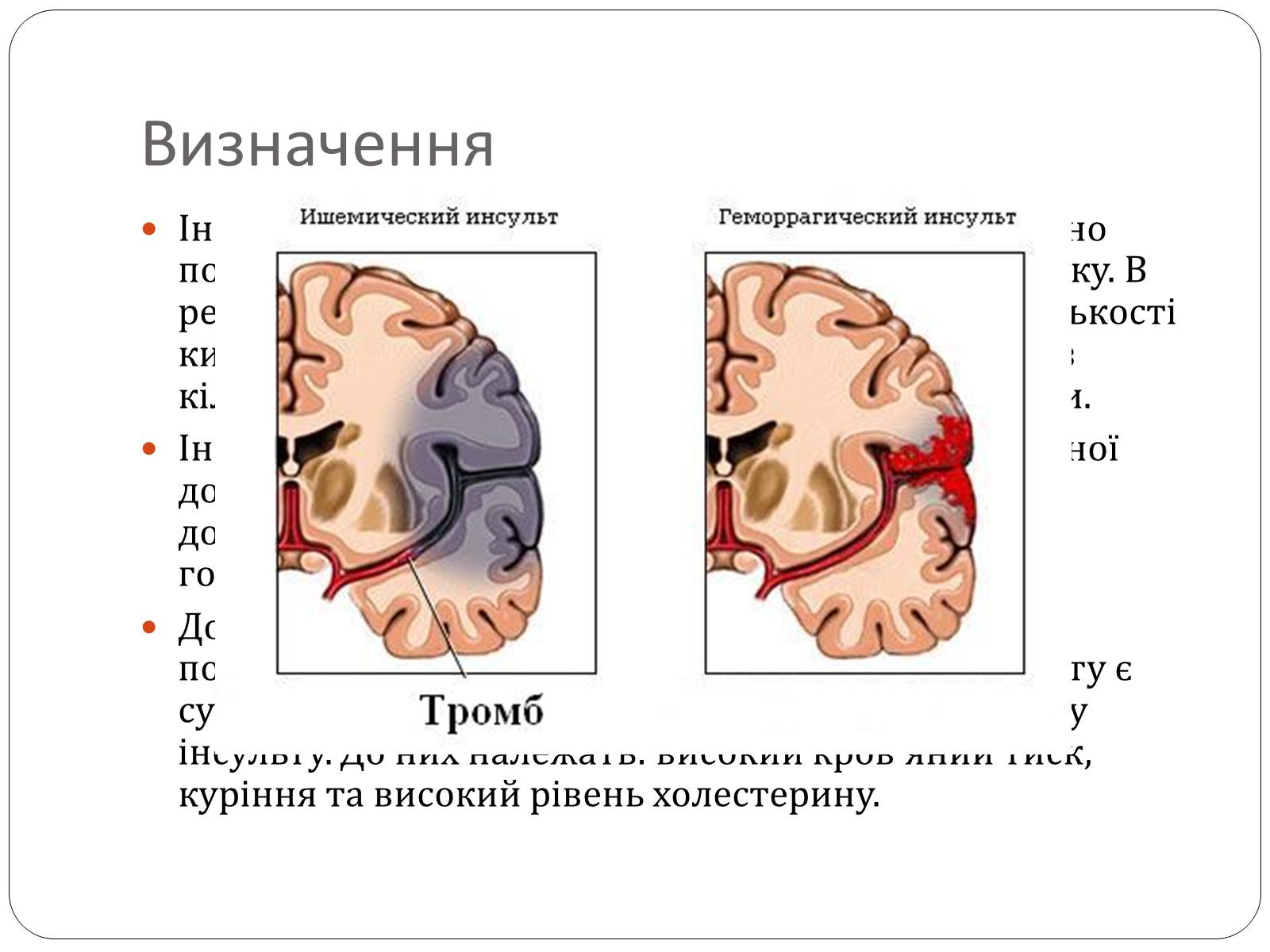 Презентація на тему «Інсульт» (варіант 2) - Слайд #3 Презентація на тему «Інсульт» (варіант 2) - Слайд #3