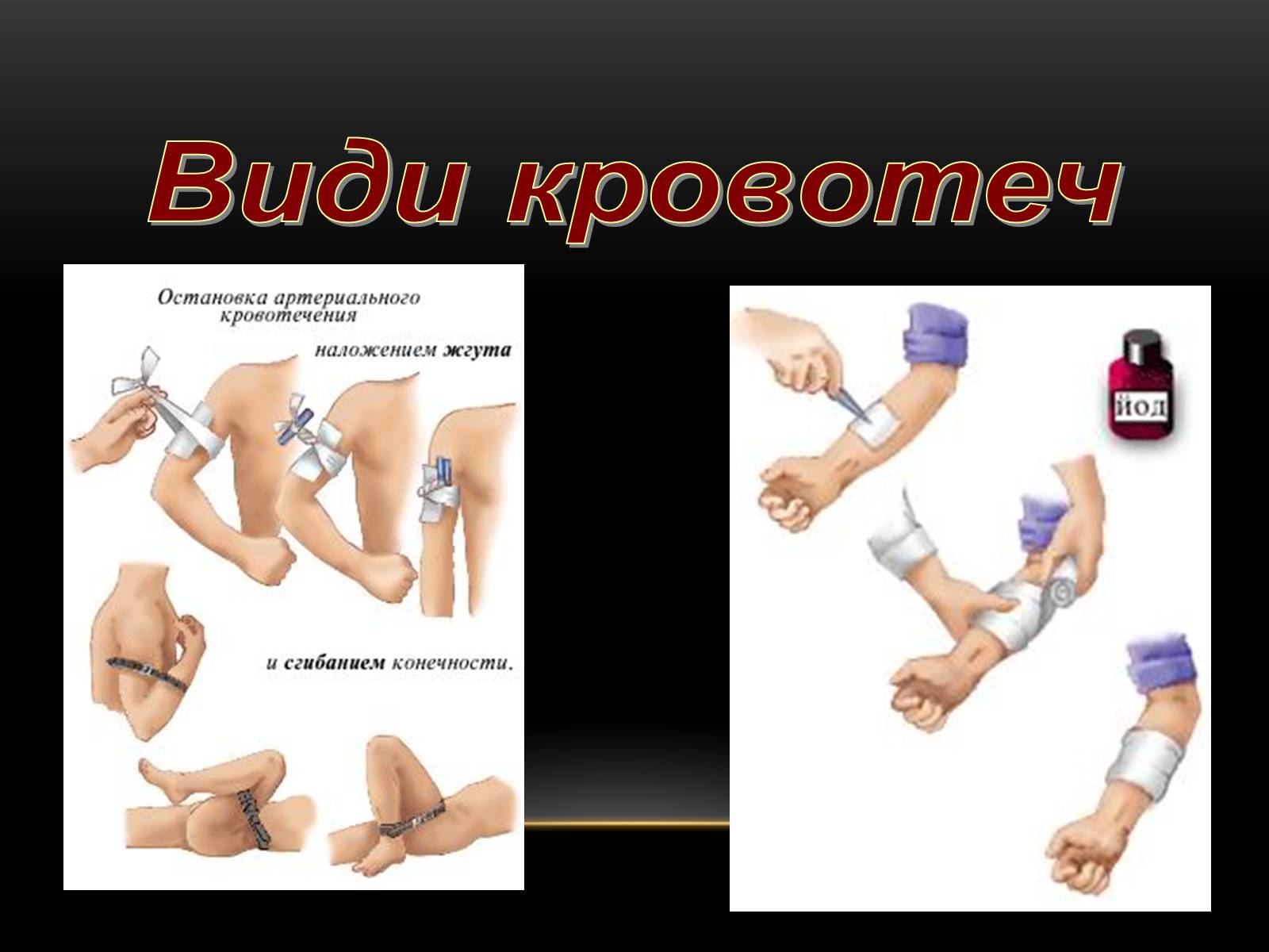 Презентація на тему «Кровообіг і лімфообіг людини» - Слайд #18 Презентація на тему «Кровообіг і лімфообіг людини» - Слайд #18