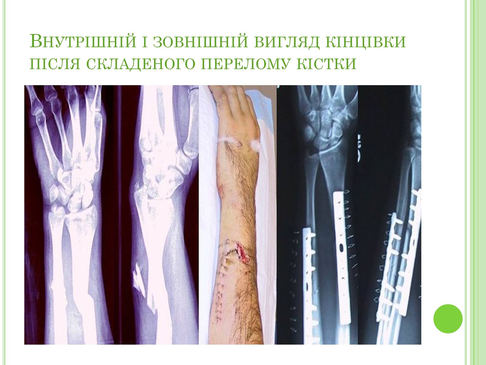 Презентація на тему «Плечовий суглоб» - Слайд #8 Презентація на тему «Плечовий суглоб» - Слайд #8