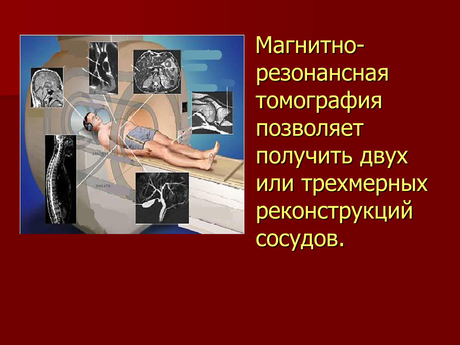 Презентація на тему «Вазоренальная гипертензия» - Слайд #10 Презентація на тему «Вазоренальная гипертензия» - Слайд #10