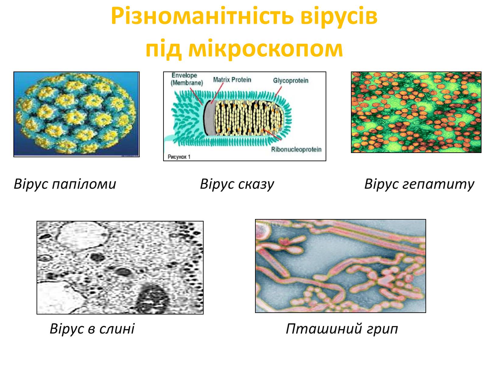 Презентація на тему «Віруси» (варіант 3) - Слайд #10 Презентація на тему «Віруси» (варіант 3) - Слайд #10