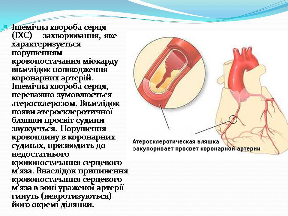 Презентація на тему «Найчастіші захвонювання людей» - Слайд #13 Презентація на тему «Найчастіші захвонювання людей» - Слайд #13