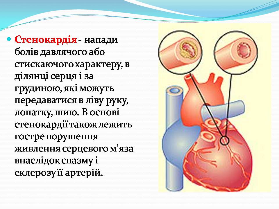 Презентація на тему «Найчастіші захвонювання людей» - Слайд #14 Презентація на тему «Найчастіші захвонювання людей» - Слайд #14