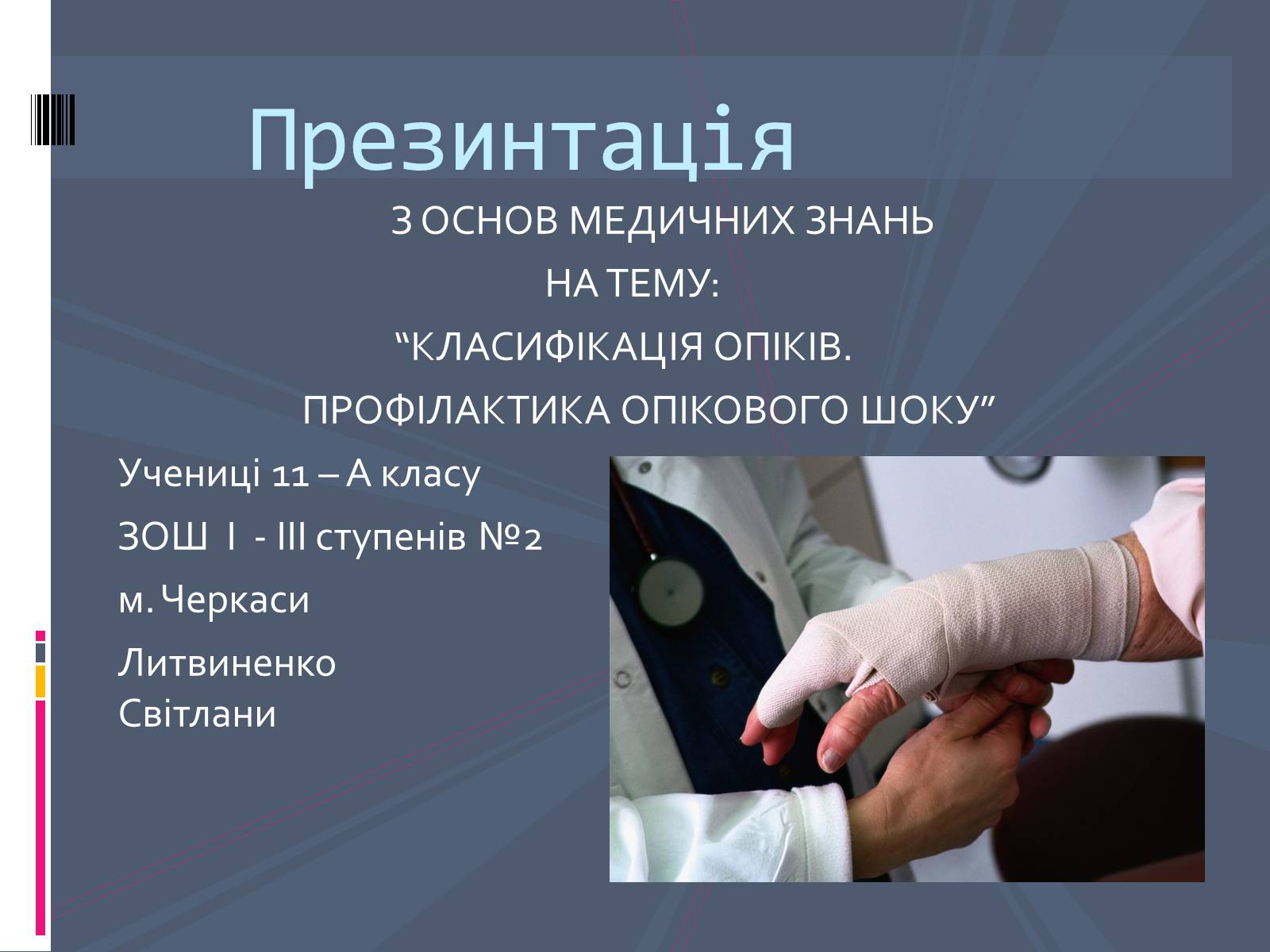 Презентація на тему «Класифікація опіків» - Слайд #1 Презентація на тему «Класифікація опіків» - Слайд #1