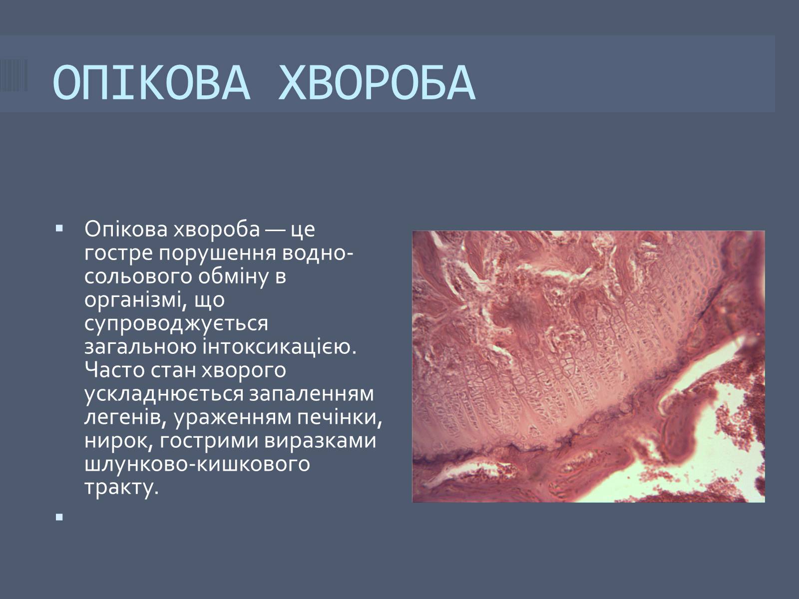 Презентація на тему «Класифікація опіків» - Слайд #5 Презентація на тему «Класифікація опіків» - Слайд #5