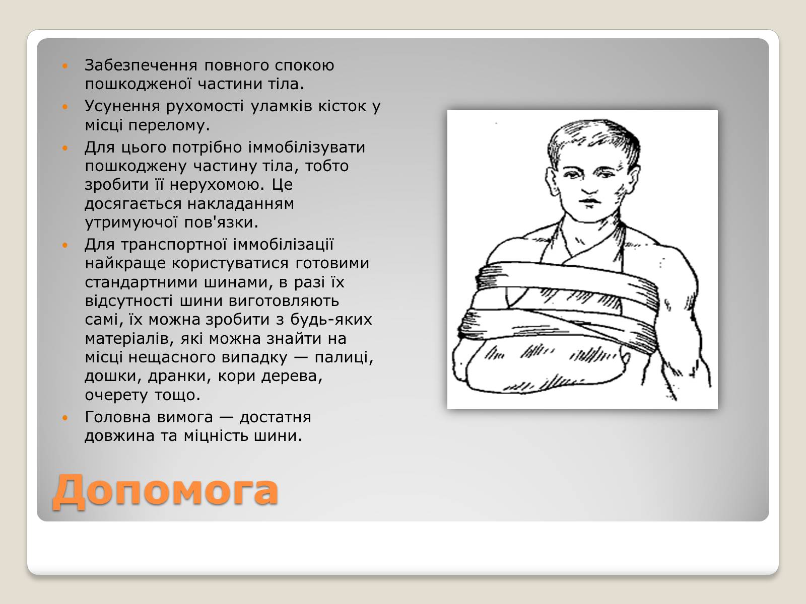 Презентація на тему «Переломи і вивихи» (варіант 3) - Слайд #8 Презентація на тему «Переломи і вивихи» (варіант 3) - Слайд #8