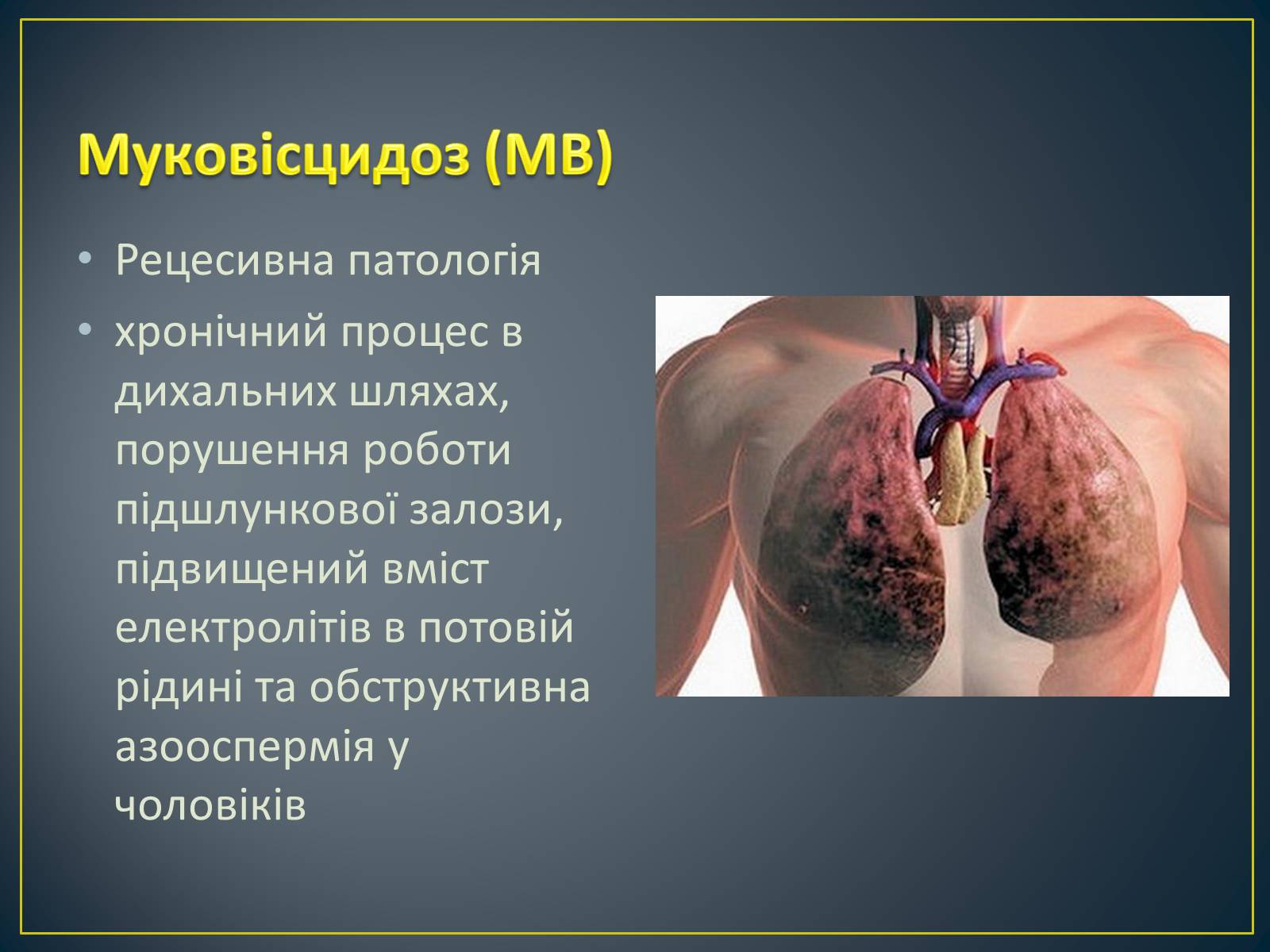Презентація на тему «Типи генетичних хвороб людини» (варіант 1) - Слайд #3 Презентація на тему «Типи генетичних хвороб людини» (варіант 1) - Слайд #3