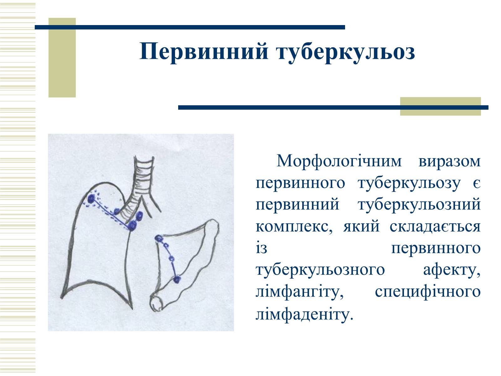 Презентація на тему «Патологічна анатомія туберкульозу» - Слайд #7 Презентація на тему «Патологічна анатомія туберкульозу» - Слайд #7