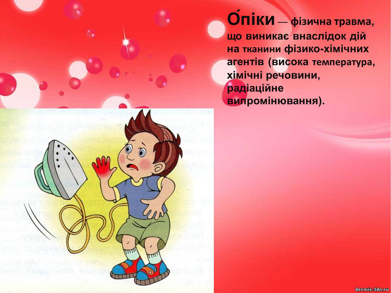 Презентація на тему «Опіки» (варіант 9) - Слайд #2 Презентація на тему «Опіки» (варіант 9) - Слайд #2