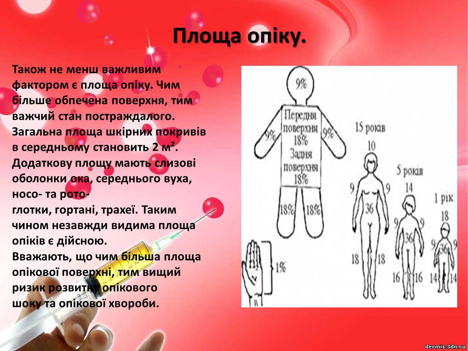 Презентація на тему «Опіки» (варіант 9) - Слайд #5 Презентація на тему «Опіки» (варіант 9) - Слайд #5