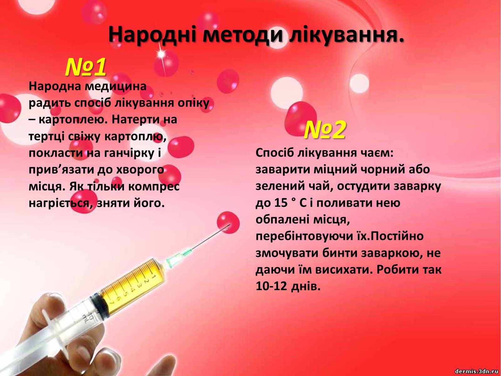 Презентація на тему «Опіки» (варіант 9) - Слайд #7 Презентація на тему «Опіки» (варіант 9) - Слайд #7