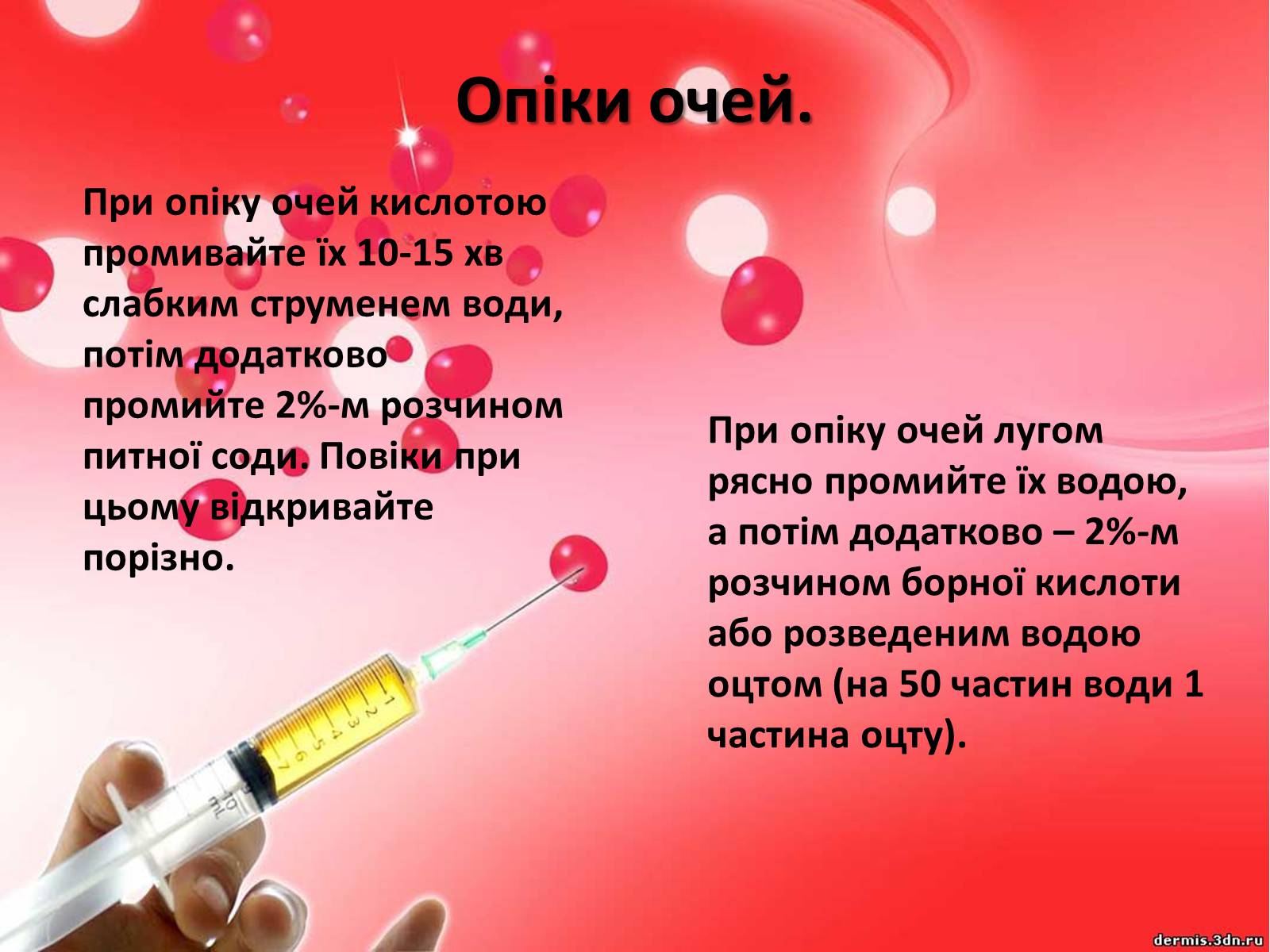 Презентація на тему «Опіки» (варіант 9) - Слайд #8 Презентація на тему «Опіки» (варіант 9) - Слайд #8