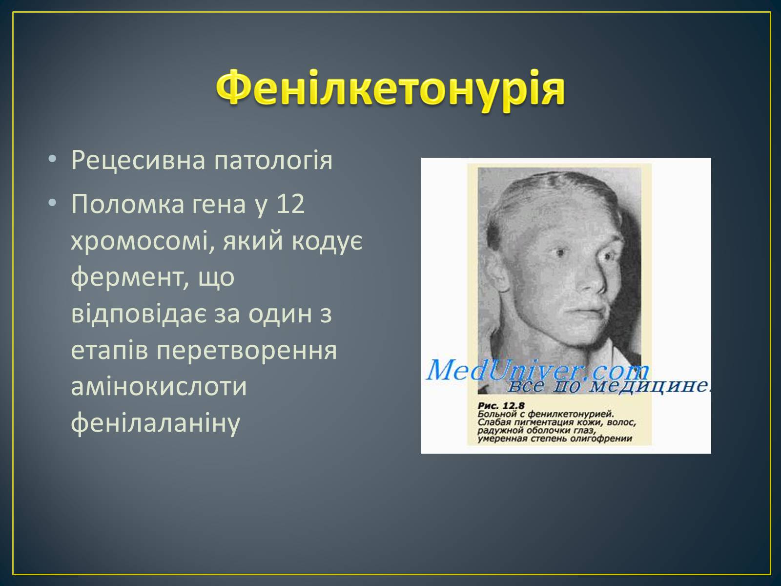 Презентація на тему «Типи генетичних хвороб людини» (варіант 3) - Слайд #10 Презентація на тему «Типи генетичних хвороб людини» (варіант 3) - Слайд #10