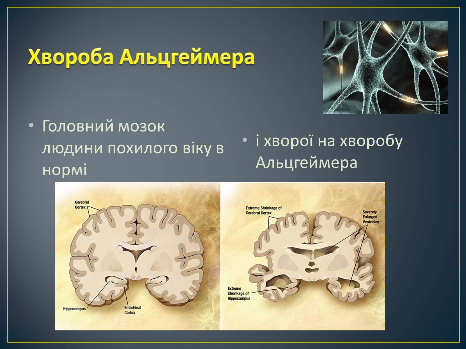 Презентація на тему «Типи генетичних хвороб людини» (варіант 3) - Слайд #12 Презентація на тему «Типи генетичних хвороб людини» (варіант 3) - Слайд #12