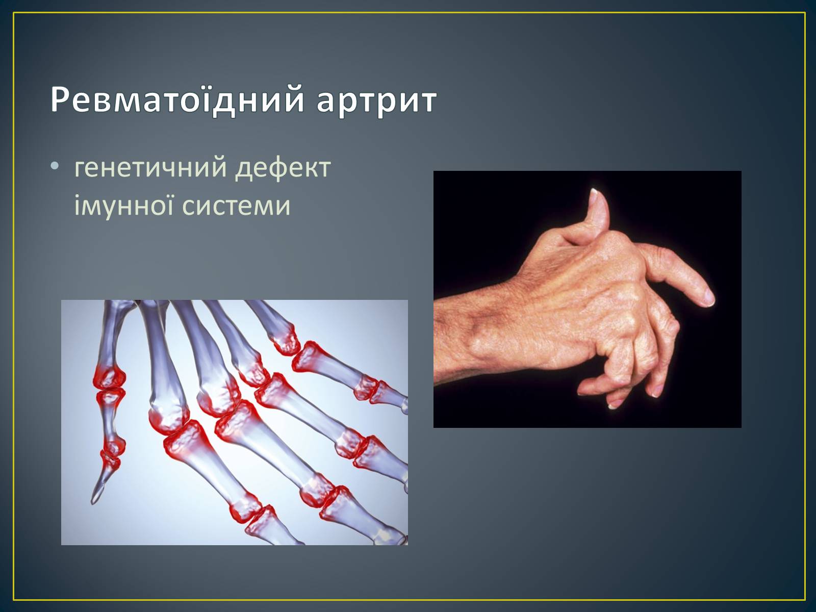 Презентація на тему «Типи генетичних хвороб людини» (варіант 3) - Слайд #14 Презентація на тему «Типи генетичних хвороб людини» (варіант 3) - Слайд #14