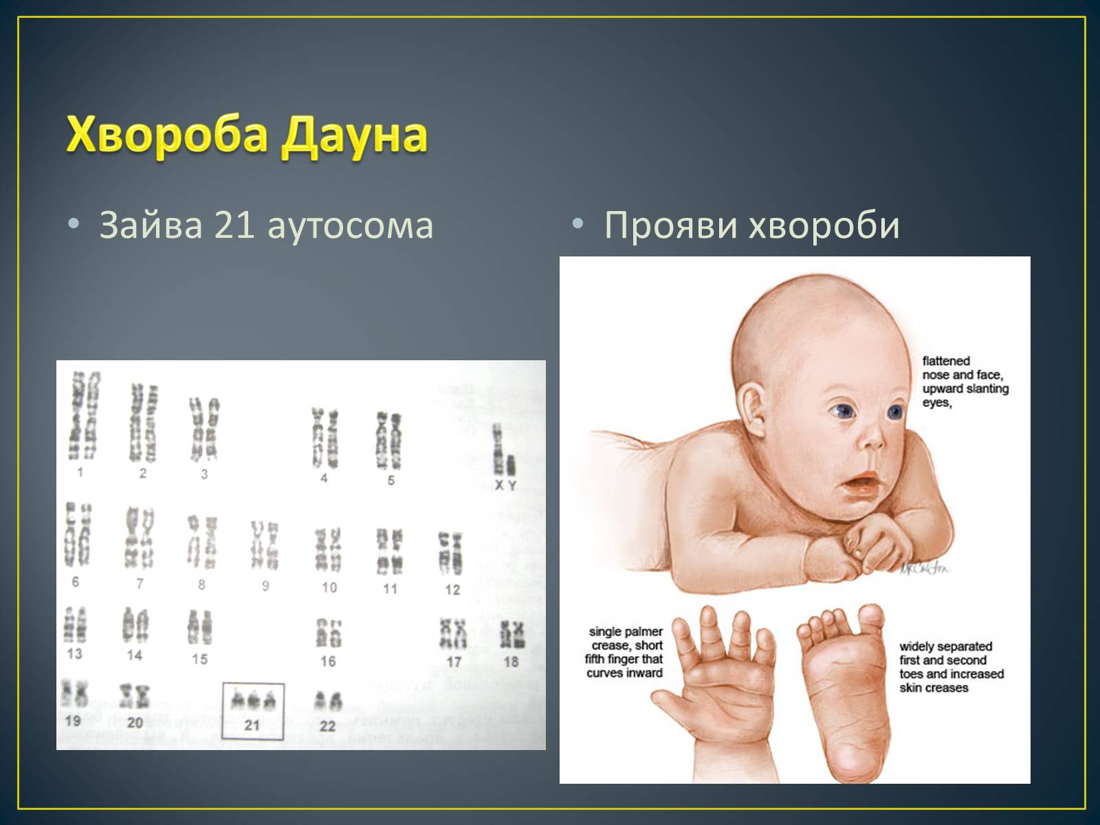 Презентація на тему «Типи генетичних хвороб людини» (варіант 3) - Слайд #16 Презентація на тему «Типи генетичних хвороб людини» (варіант 3) - Слайд #16