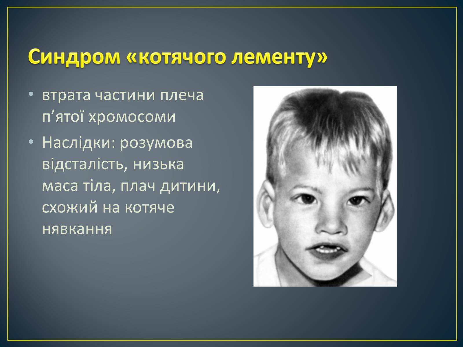 Презентація на тему «Типи генетичних хвороб людини» (варіант 3) - Слайд #17 Презентація на тему «Типи генетичних хвороб людини» (варіант 3) - Слайд #17
