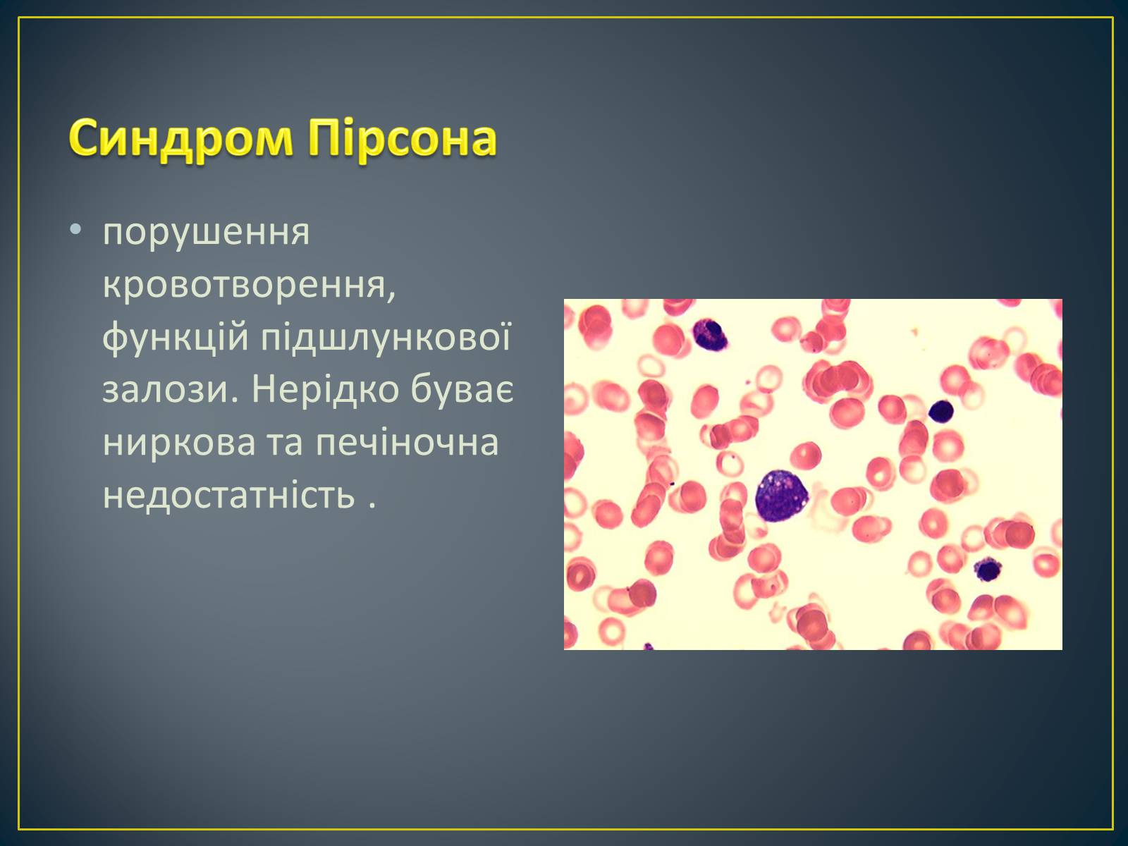 Презентація на тему «Типи генетичних хвороб людини» (варіант 3) - Слайд #20 Презентація на тему «Типи генетичних хвороб людини» (варіант 3) - Слайд #20