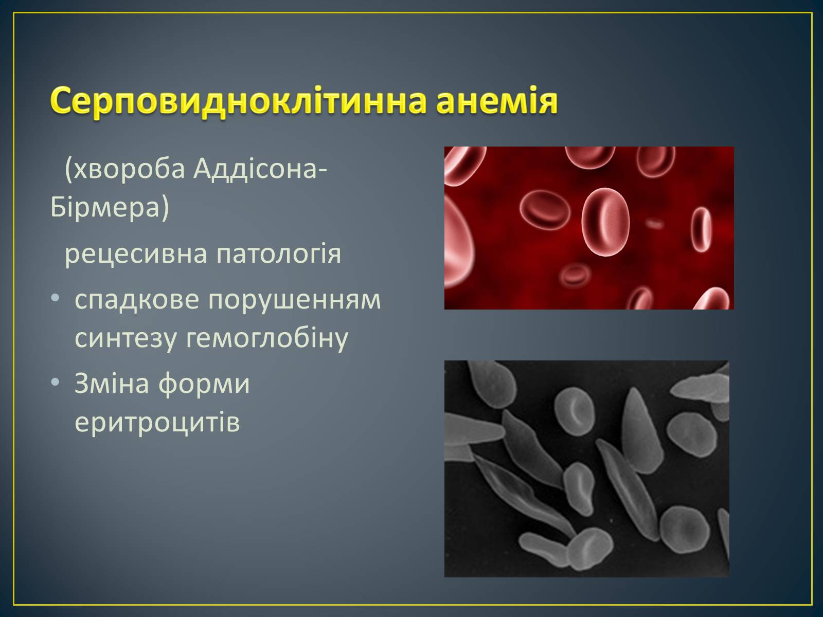 Презентація на тему «Типи генетичних хвороб людини» (варіант 3) - Слайд #7 Презентація на тему «Типи генетичних хвороб людини» (варіант 3) - Слайд #7
