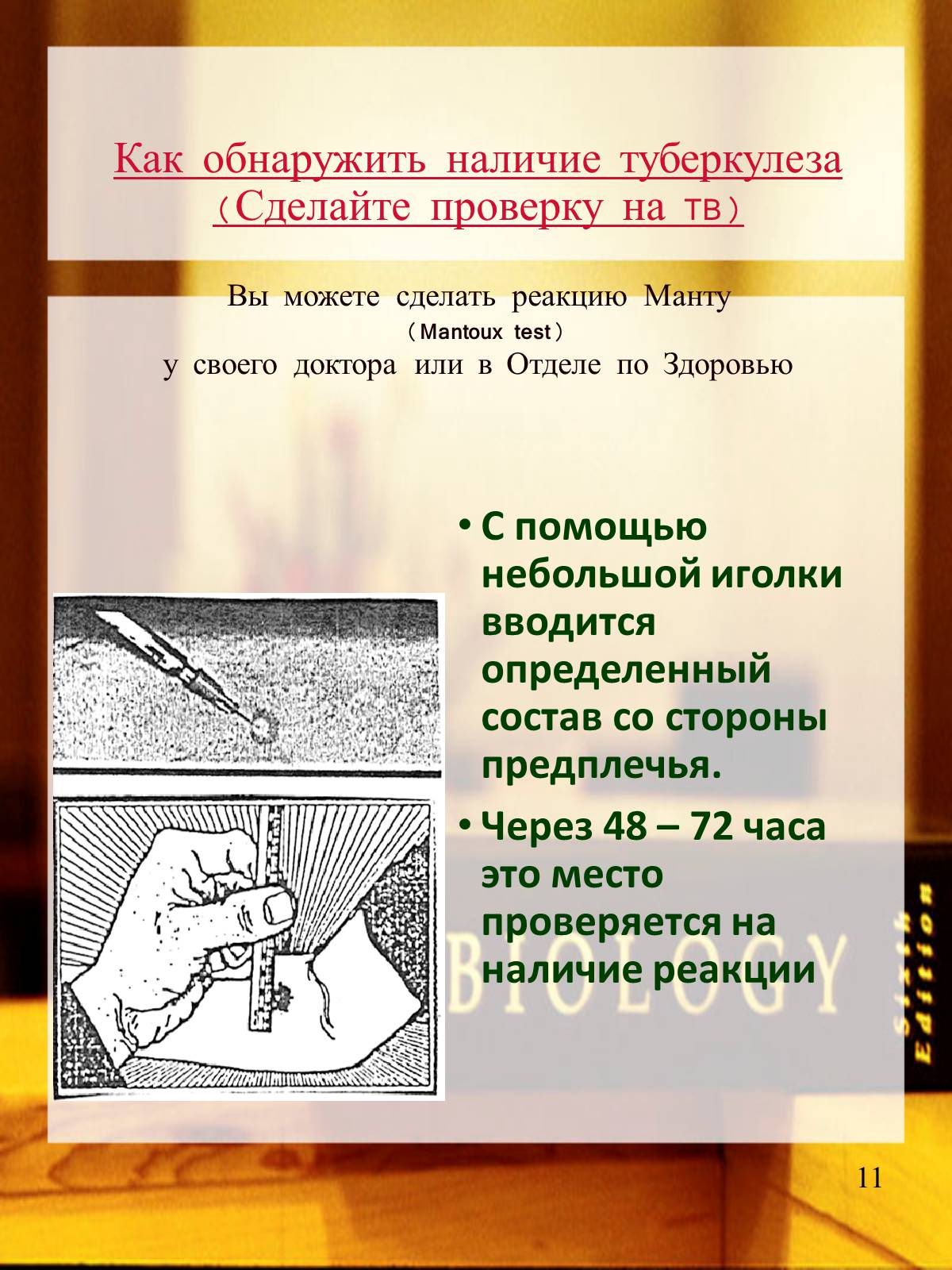 Презентація на тему «Туберкулез» (варіант 2) - Слайд #12 Презентація на тему «Туберкулез» (варіант 2) - Слайд #12