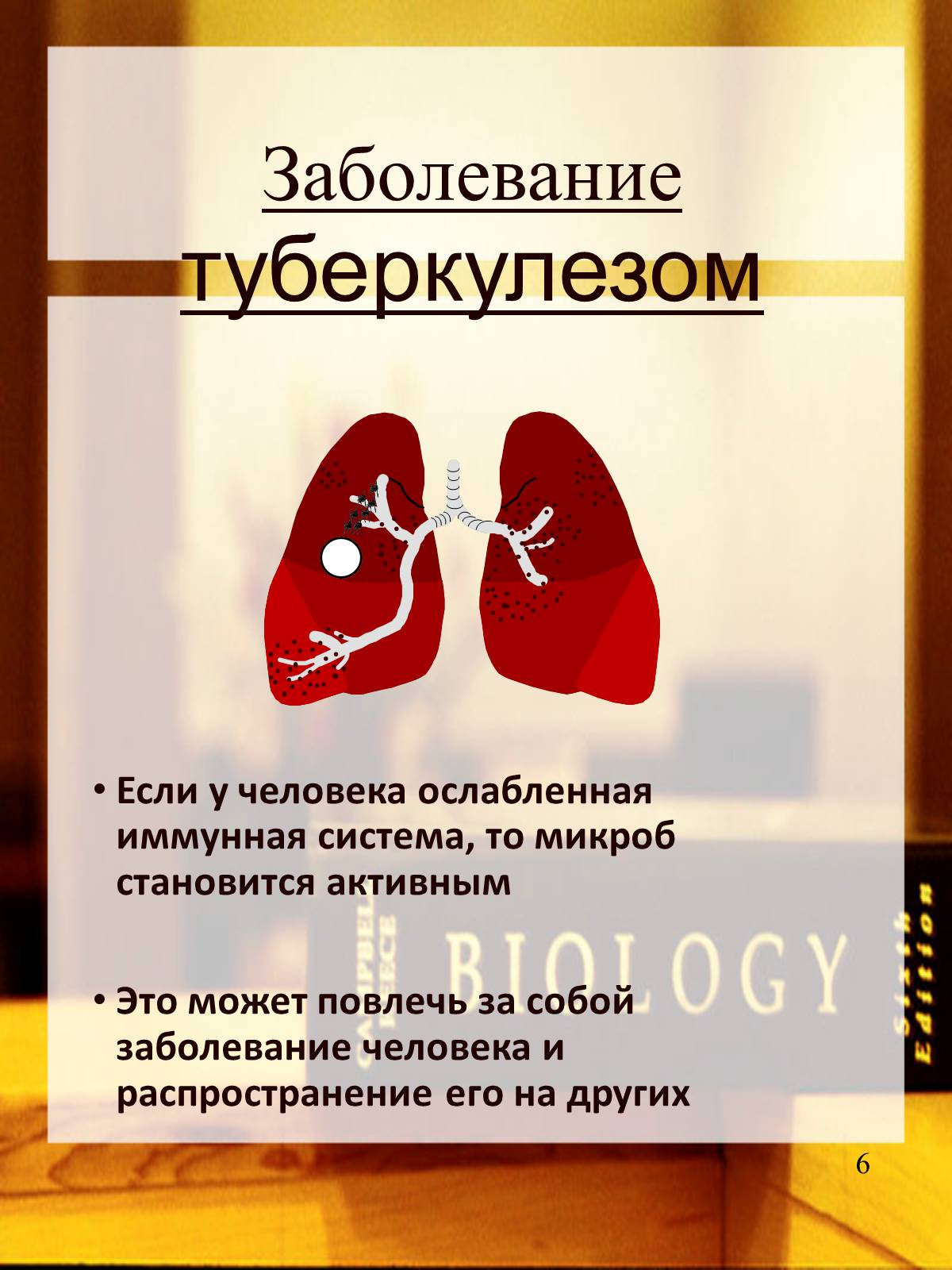 Презентація на тему «Туберкулез» (варіант 2) - Слайд #7 Презентація на тему «Туберкулез» (варіант 2) - Слайд #7