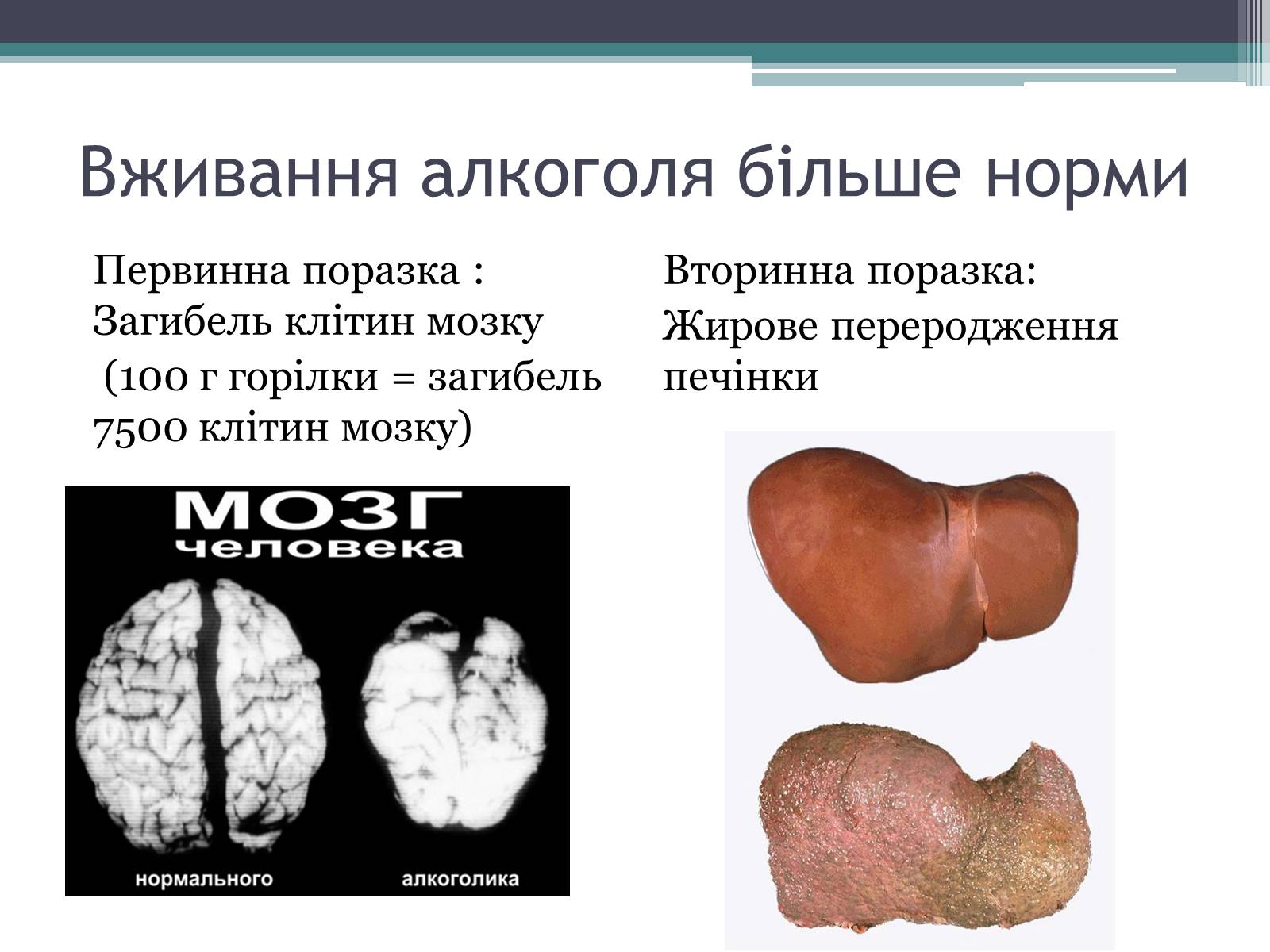 Презентація на тему «Алкоголь» (варіант 3) - Слайд #7 Презентація на тему «Алкоголь» (варіант 3) - Слайд #7