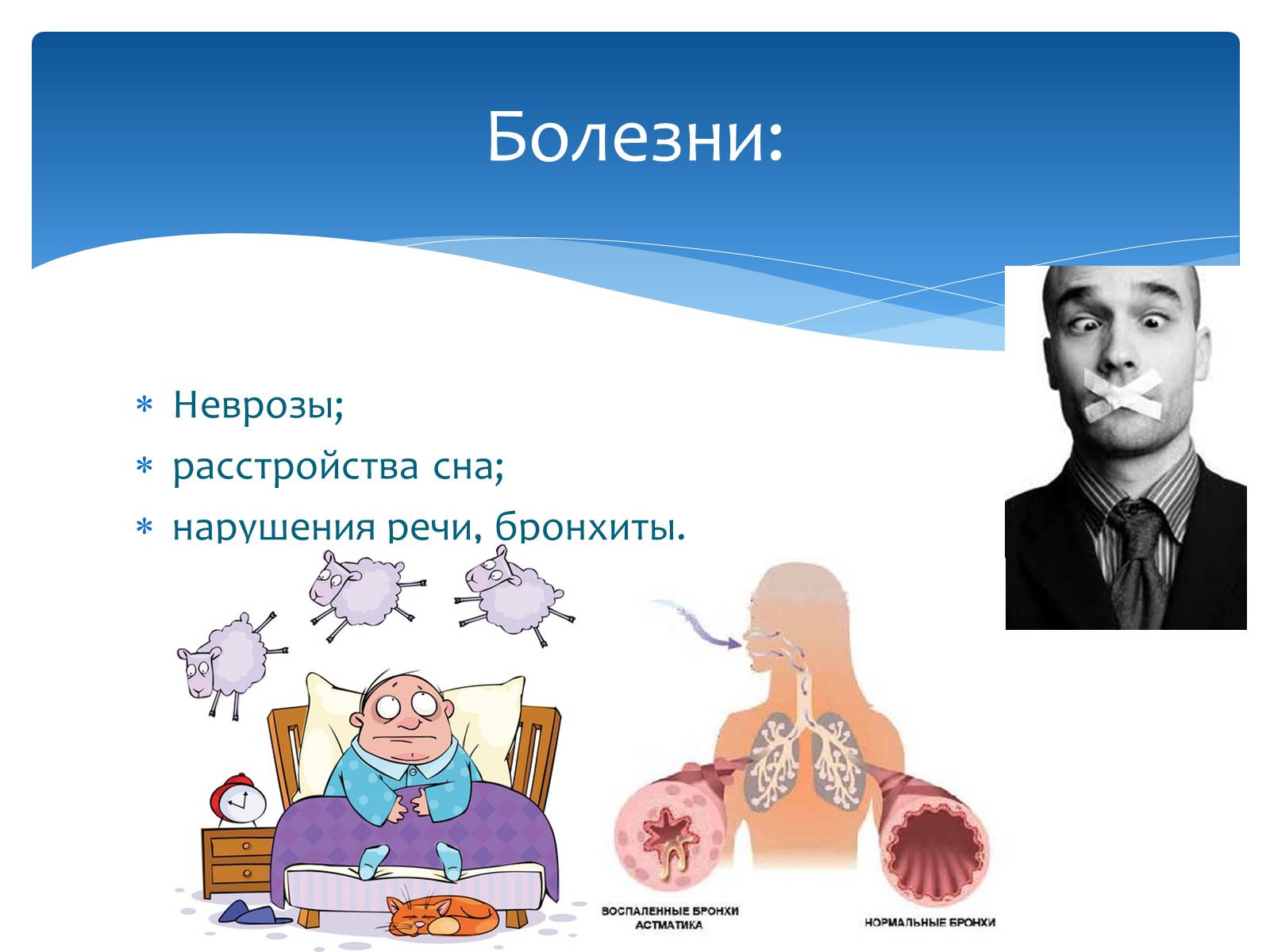 Презентація на тему «Здоровье по зодиакам» - Слайд #14 Презентація на тему «Здоровье по зодиакам» - Слайд #14
