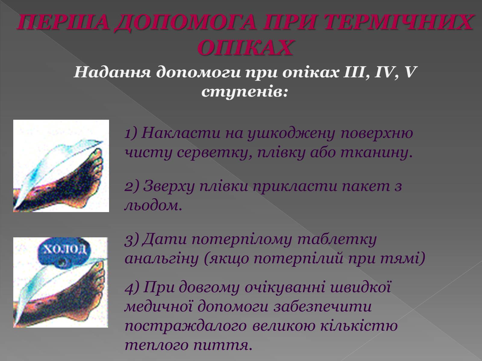 Презентація на тему «Опіки» (варіант 6) - Слайд #12 Презентація на тему «Опіки» (варіант 6) - Слайд #12