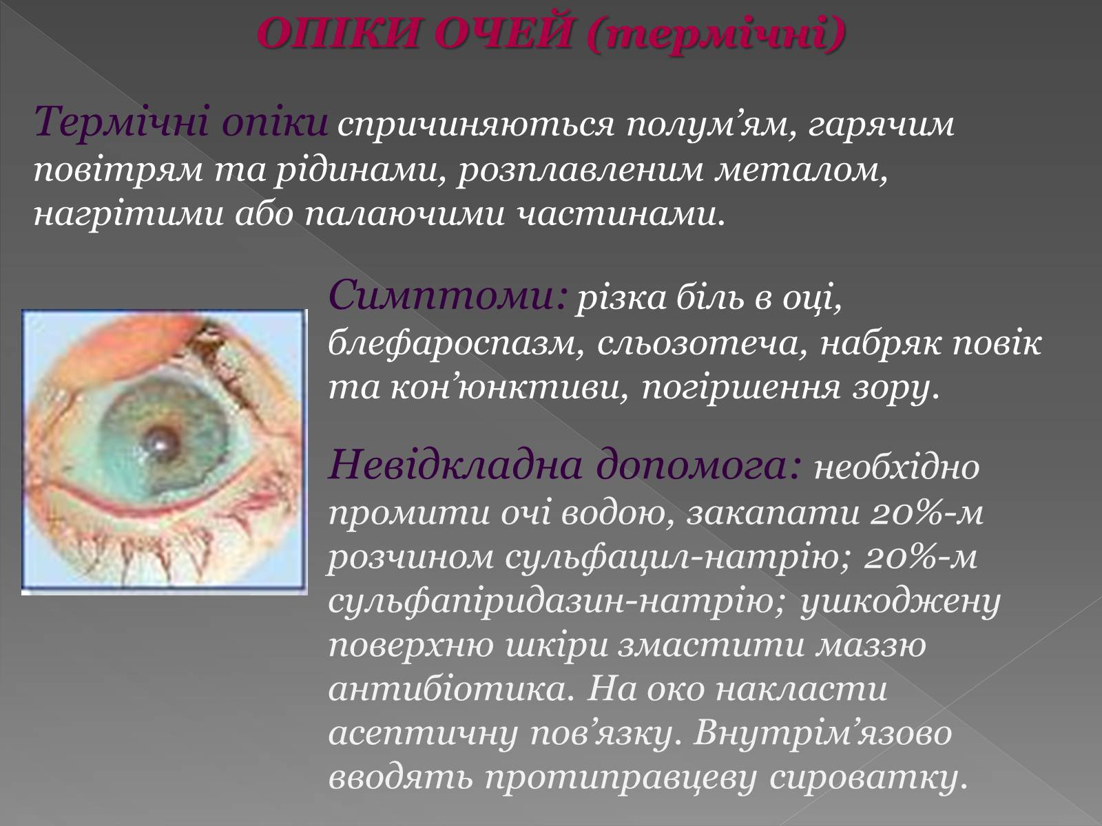 Презентація на тему «Опіки» (варіант 6) - Слайд #18 Презентація на тему «Опіки» (варіант 6) - Слайд #18