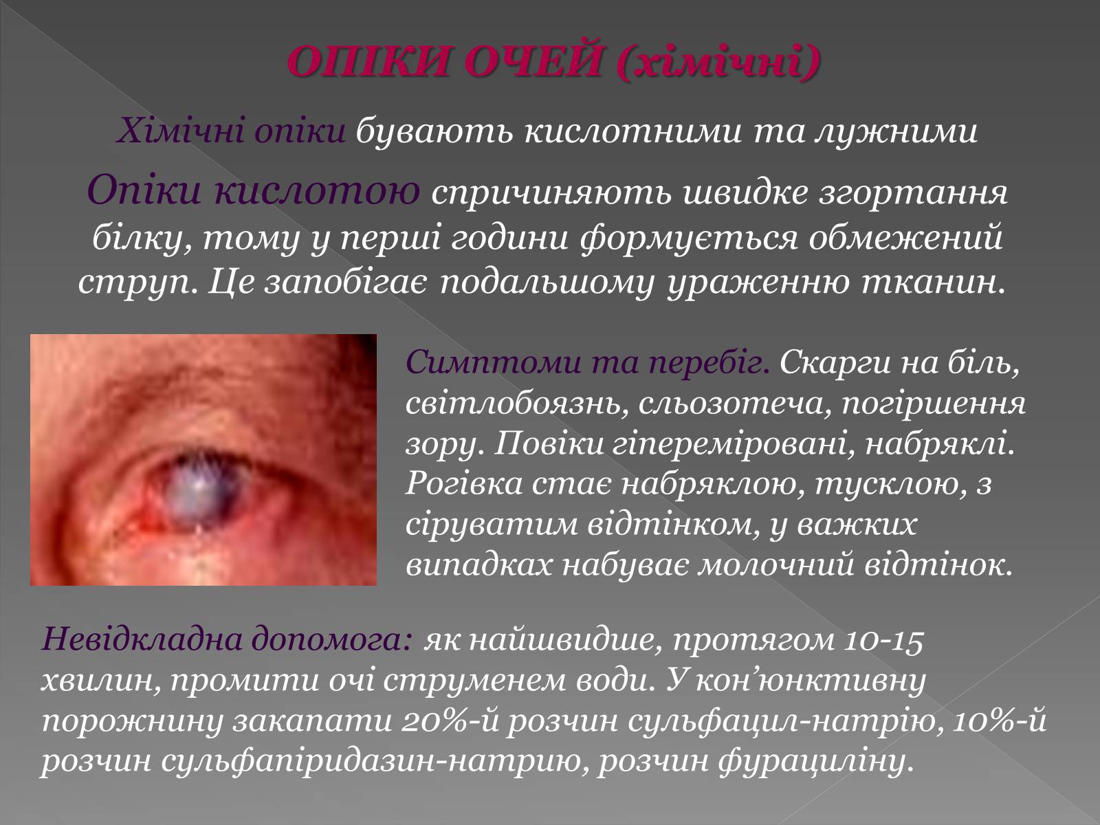 Презентація на тему «Опіки» (варіант 6) - Слайд #19 Презентація на тему «Опіки» (варіант 6) - Слайд #19
