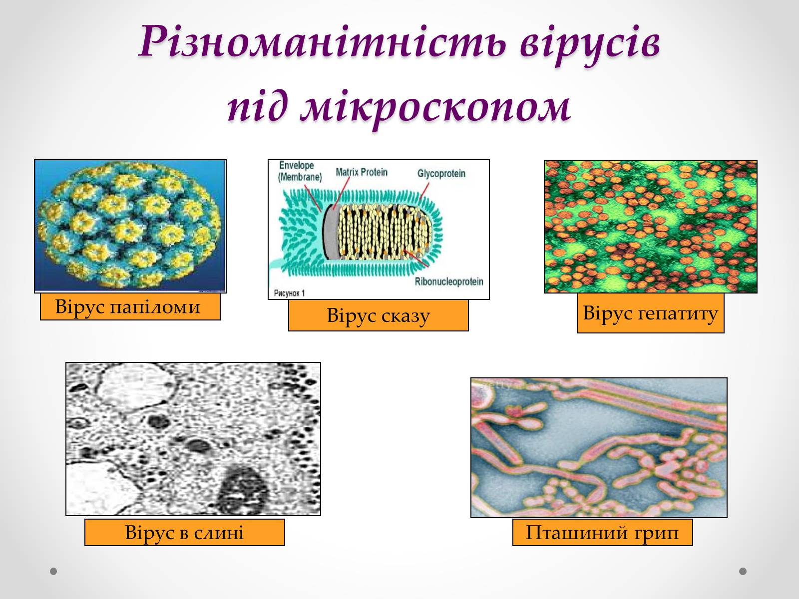 Презентація на тему «Вірусобіологія» - Слайд #11 Презентація на тему «Вірусобіологія» - Слайд #11