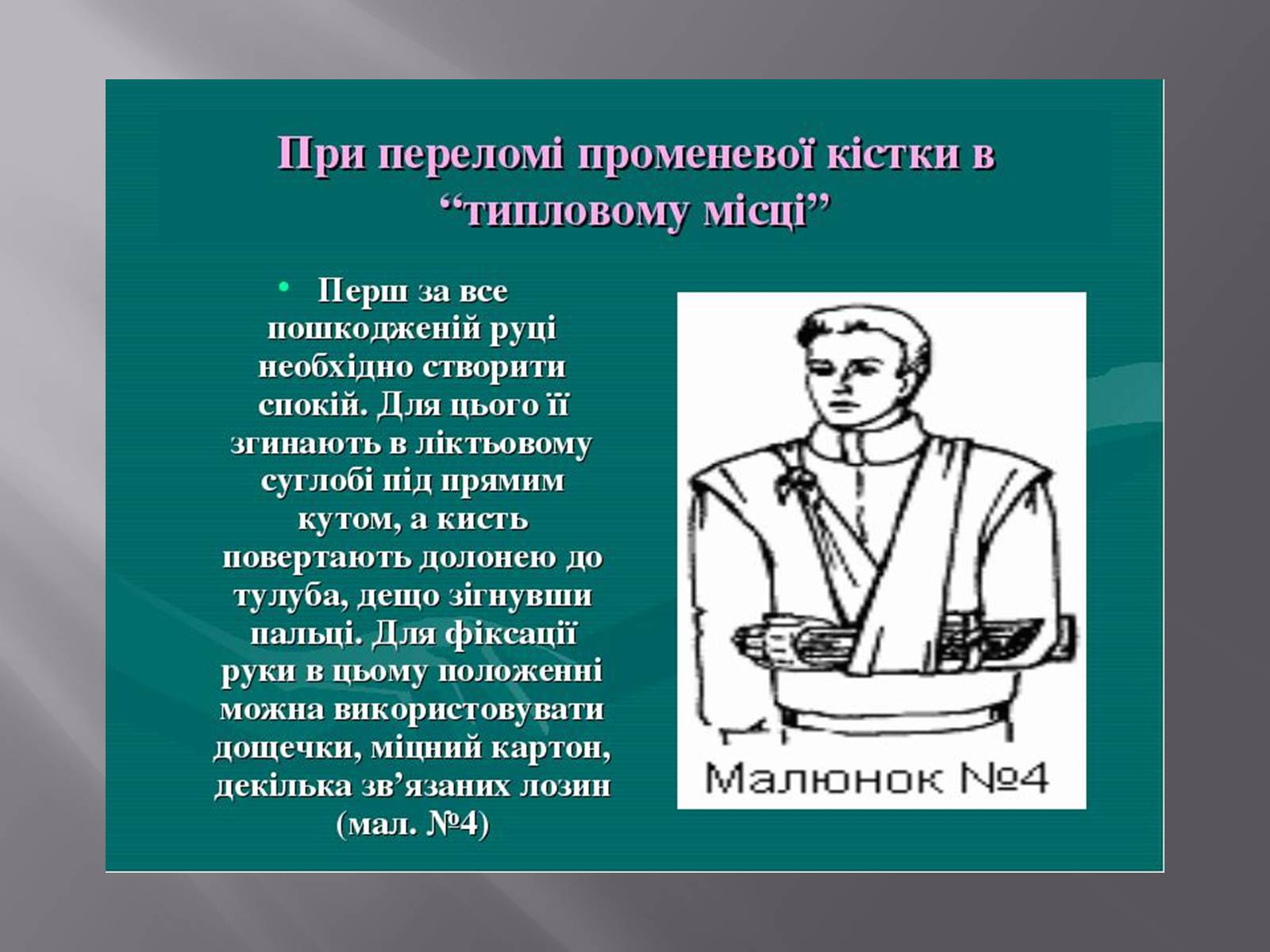 Презентація на тему «Преломи» - Слайд #11 Презентація на тему «Преломи» - Слайд #11