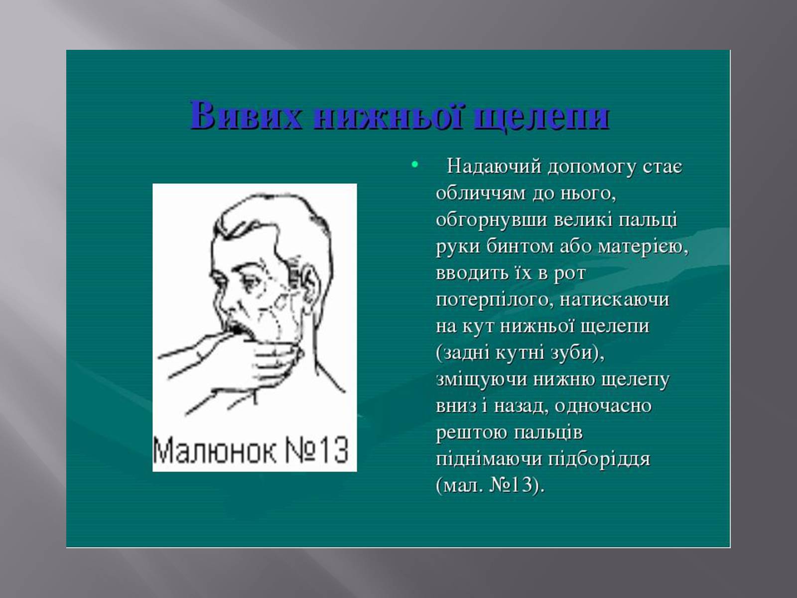 Презентація на тему «Преломи» - Слайд #17 Презентація на тему «Преломи» - Слайд #17