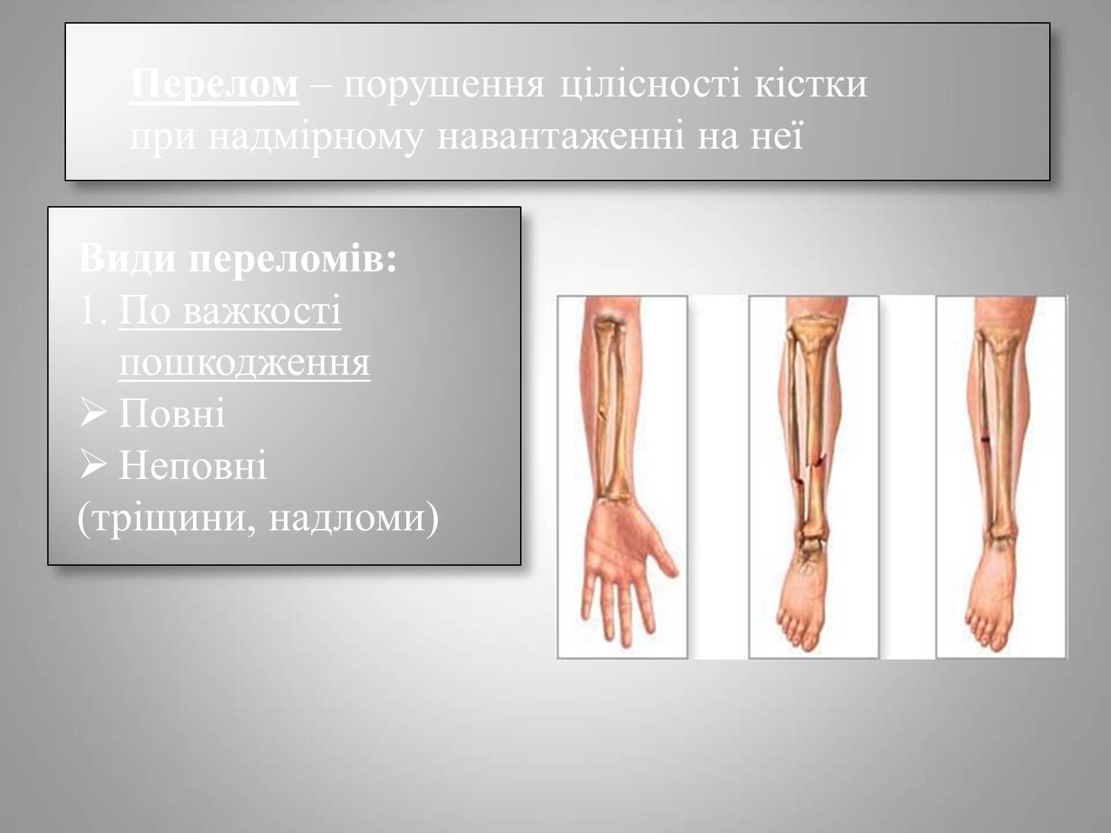 Презентація на тему «Преломи» - Слайд #3 Презентація на тему «Преломи» - Слайд #3