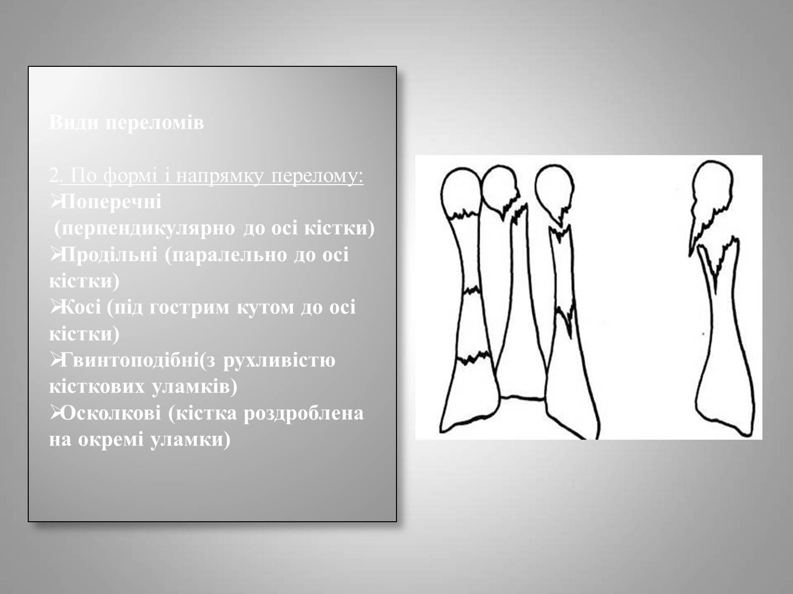 Презентація на тему «Преломи» - Слайд #4 Презентація на тему «Преломи» - Слайд #4