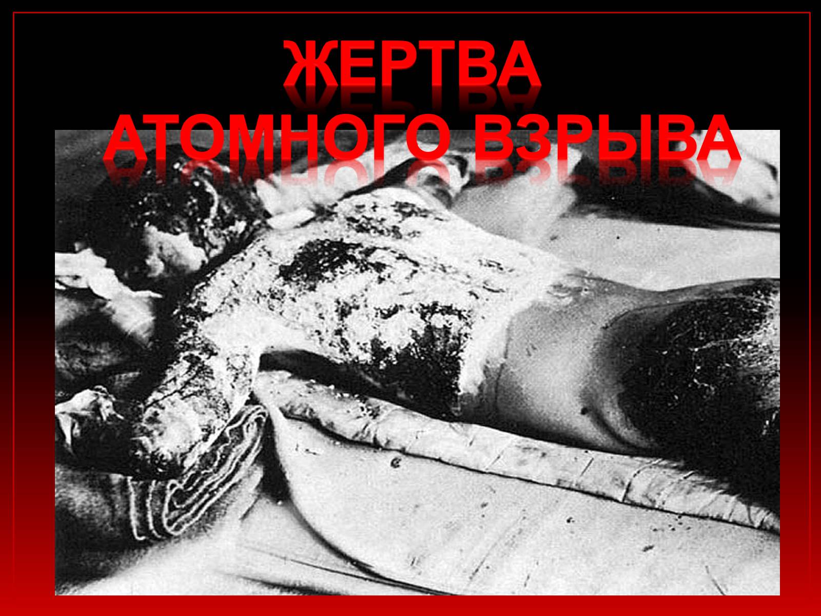 Презентація на тему «Колокола Хиросимы» - Слайд #12 Презентація на тему «Колокола Хиросимы» - Слайд #12