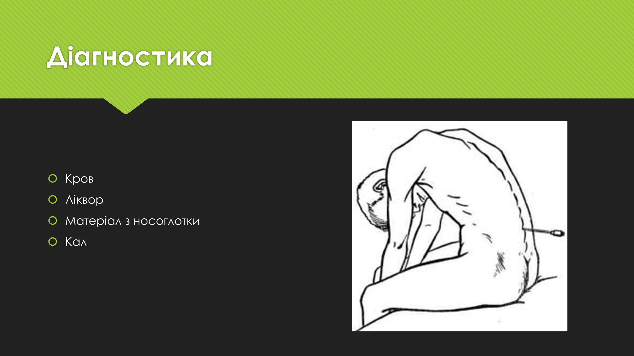 Презентація на тему «Поліомієліт» (варіант 1) - Слайд #9 Презентація на тему «Поліомієліт» (варіант 1) - Слайд #9