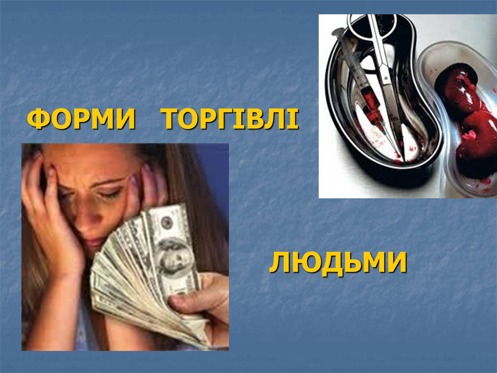 Презентація на тему «Торгівля людьми» - Слайд #5 Презентація на тему «Торгівля людьми» - Слайд #5