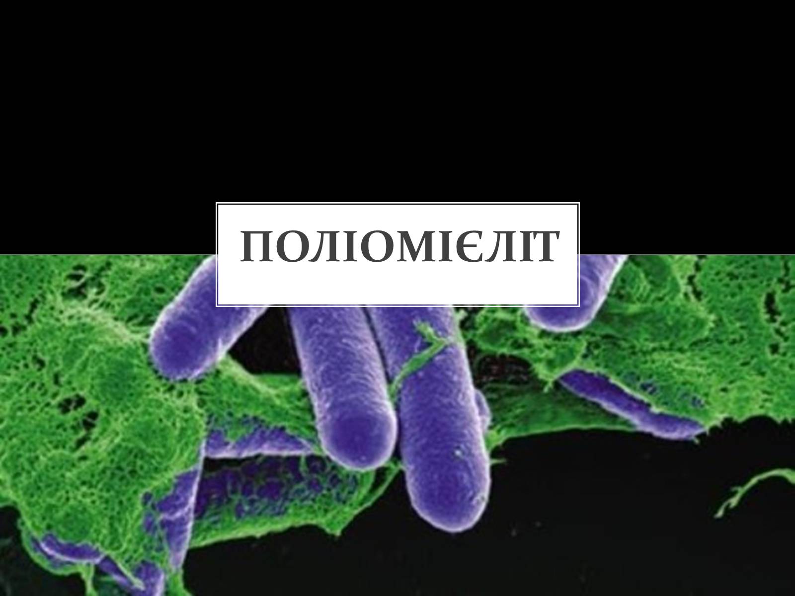 Презентація на тему «Поліомієліт» (варіант 2) - Слайд #1 Презентація на тему «Поліомієліт» (варіант 2) - Слайд #1