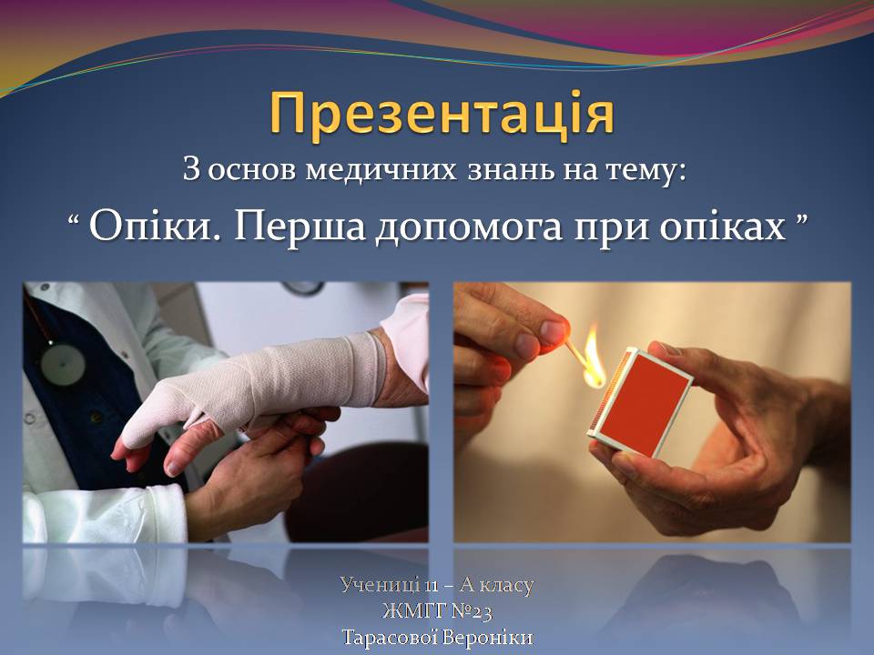Презентація на тему «Опіки. Перша допомога при опіках» - Слайд #1 Презентація на тему «Опіки. Перша допомога при опіках» - Слайд #1