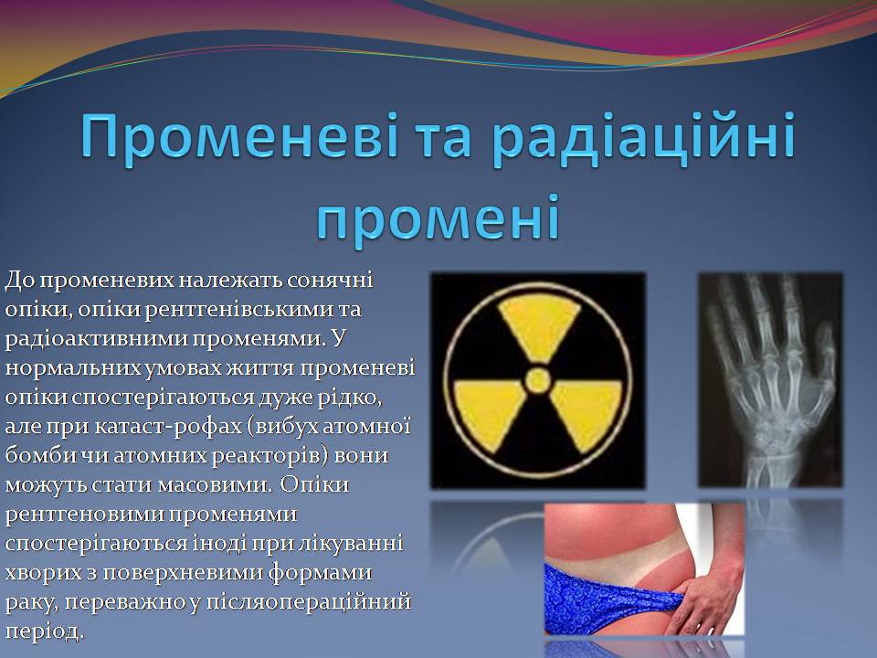 Презентація на тему «Опіки. Перша допомога при опіках» - Слайд #6 Презентація на тему «Опіки. Перша допомога при опіках» - Слайд #6