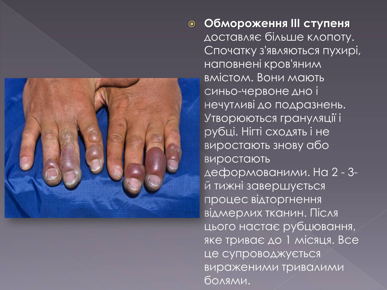 Презентація на тему «Небезпека обмороження» - Слайд #8 Презентація на тему «Небезпека обмороження» - Слайд #8
