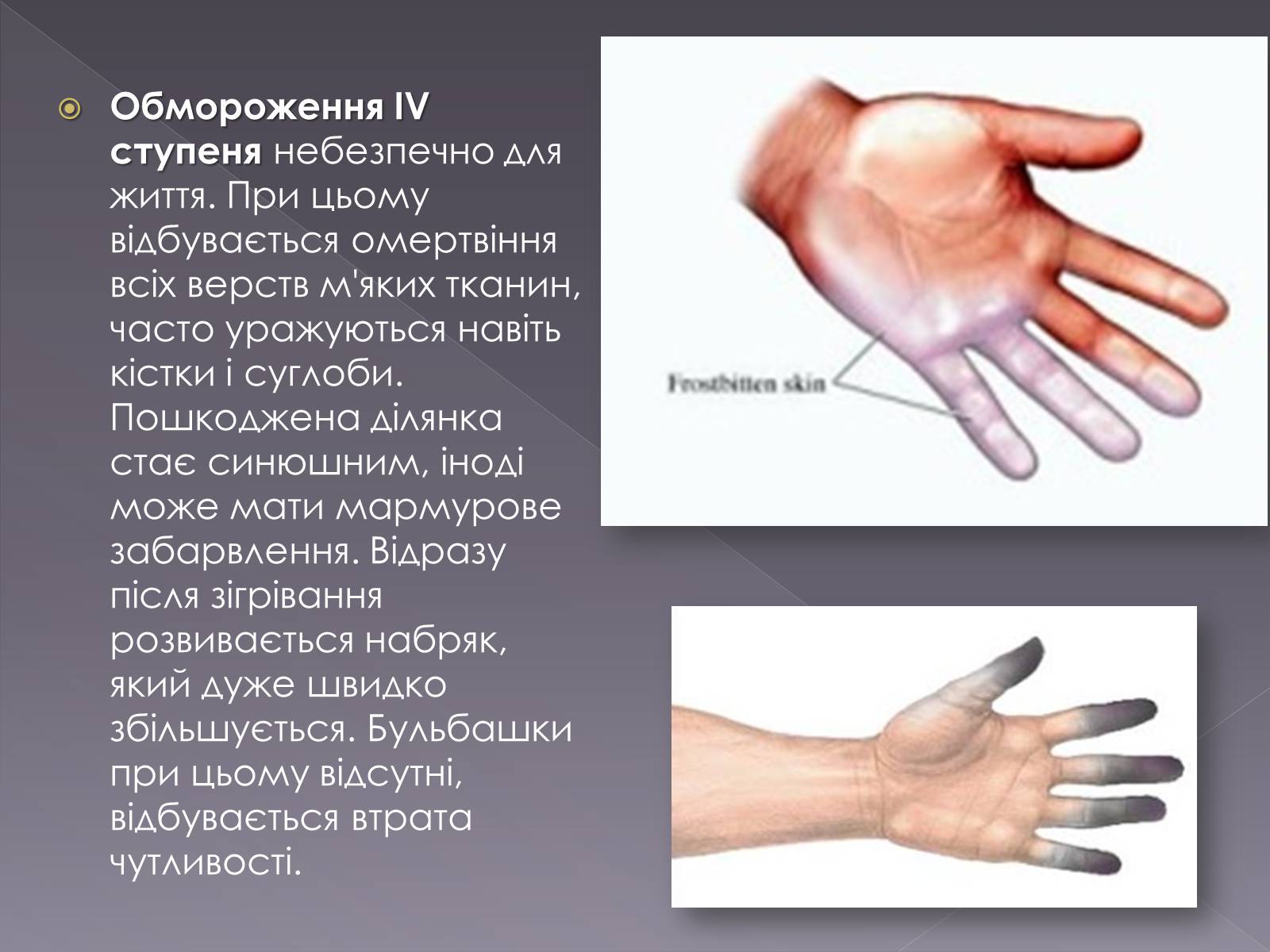 Презентація на тему «Небезпека обмороження» - Слайд #9 Презентація на тему «Небезпека обмороження» - Слайд #9
