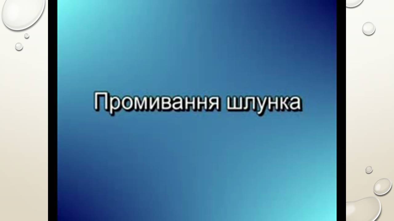 Презентація на тему «Перша допомога при захворюваннях шлунково-кишкового тракту та сечовивідної системи» - Слайд #17 Презентація на тему «Перша допомога при захворюваннях шлунково-кишкового тракту та сечовивідної системи» - Слайд #17