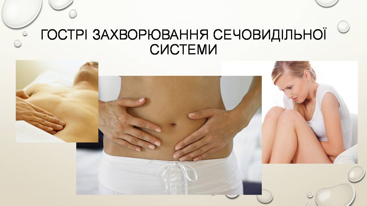 Презентація на тему «Перша допомога при захворюваннях шлунково-кишкового тракту та сечовивідної системи» - Слайд #9 Презентація на тему «Перша допомога при захворюваннях шлунково-кишкового тракту та сечовивідної системи» - Слайд #9