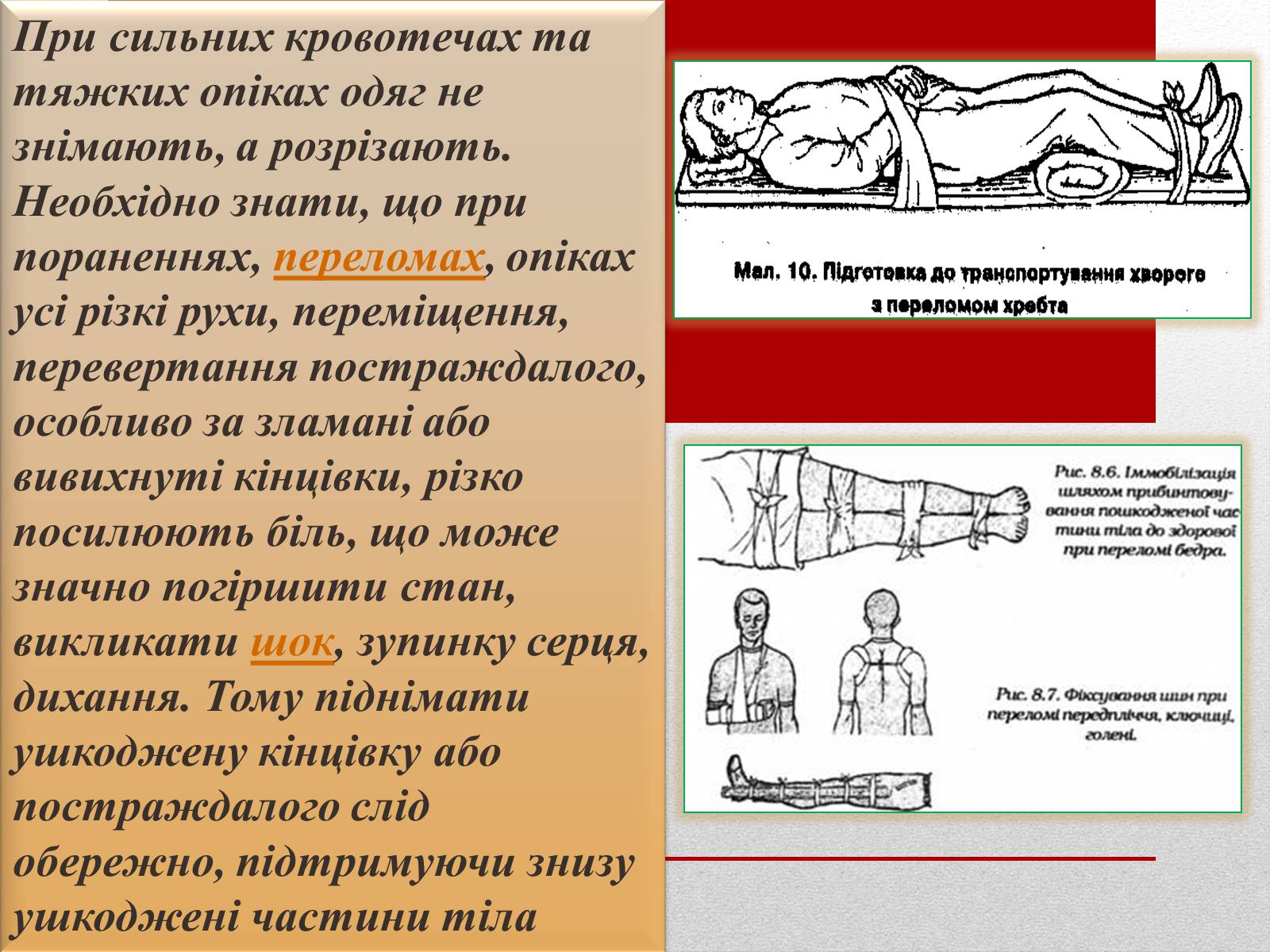 Презентація на тему «Основні способи реанімації і транспортування постраждалого» - Слайд #14 Презентація на тему «Основні способи реанімації і транспортування постраждалого» - Слайд #14