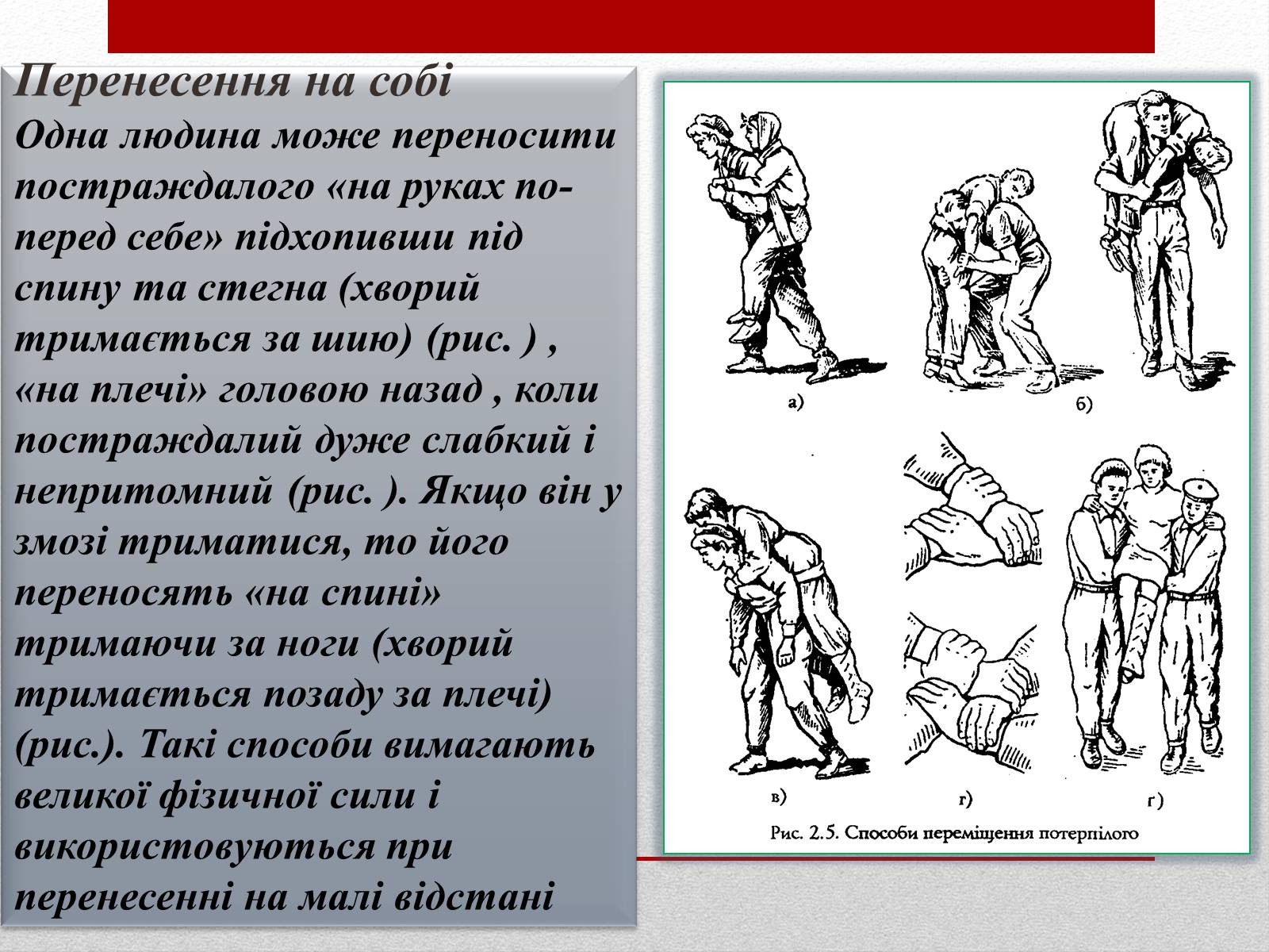 Презентація на тему «Основні способи реанімації і транспортування постраждалого» - Слайд #18 Презентація на тему «Основні способи реанімації і транспортування постраждалого» - Слайд #18