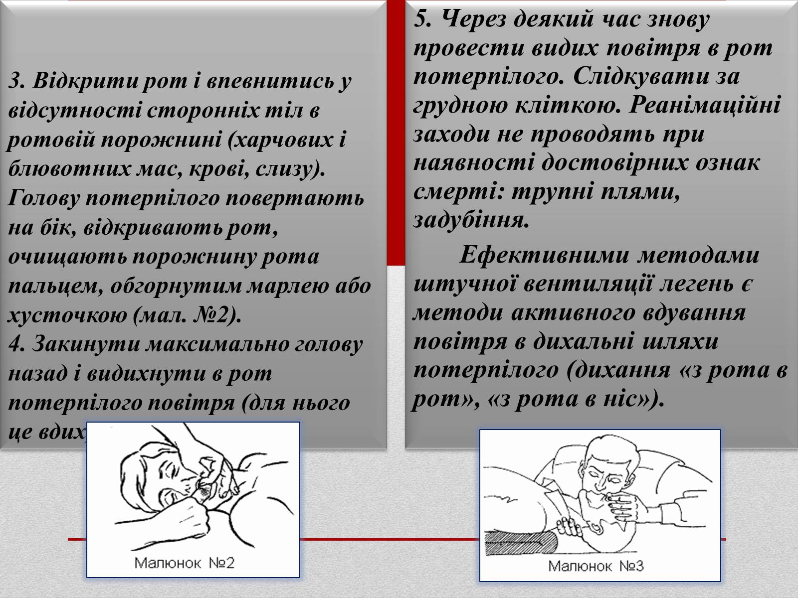 Презентація на тему «Основні способи реанімації і транспортування постраждалого» - Слайд #5 Презентація на тему «Основні способи реанімації і транспортування постраждалого» - Слайд #5